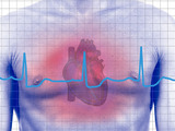 Většinu infarktů si lidé způsobí sami - nezdravým životem 