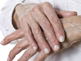 Revmatoidní artritida - příznaky které byste neměli ignorovat
