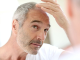 Alopecie aneb když vlasy padají více než mají