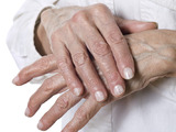 Artróza versus artritida