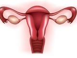 Syndrom polycystických ovarií (PCOS)