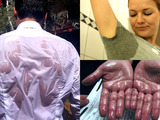 Jednoznačná pomoc proti nadměrnému pocení kdekoli na těle? Lékaři používají Electro Antiperspirant