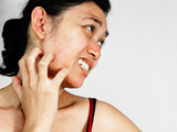 Atopická dermatitida není pouhá vyrážka