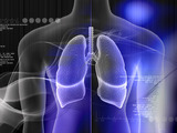 Plicní hypertenze: Vysoký krevní tlak mohou mít i plíce
