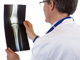 Lidé s nemocnými ledvinami mají sklon k řídnutí kostí