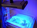 V Opavě léčí děti se žloutenkou modrým světlem 