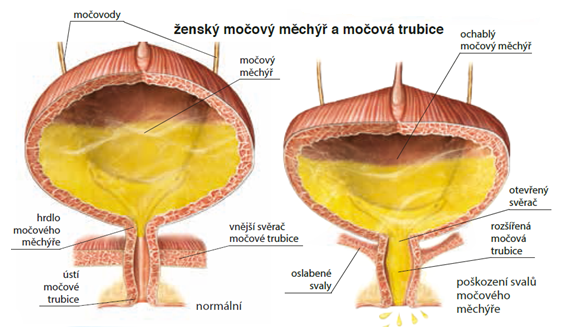 ženský močový měchýř