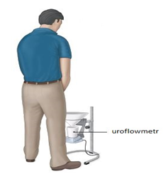 uroflometrie