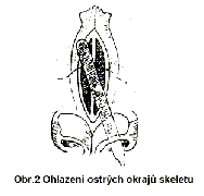 Operace nosu (rhinoplastika)