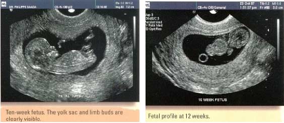 Těhotenství a ultrazvuk I