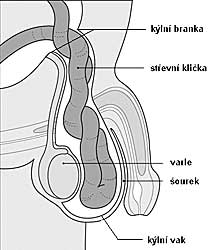 Kýla