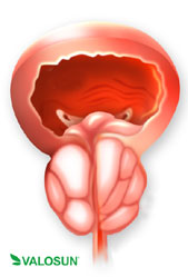 Prostata Prostata